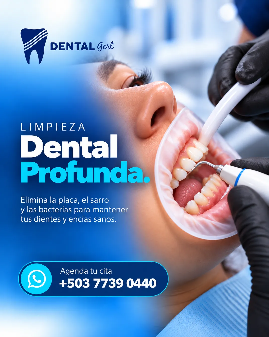 Pieza «Limpieza dental profunda»: elimina la placa, el sarro y las bacterias para mantener tus dientes y encías sanos.