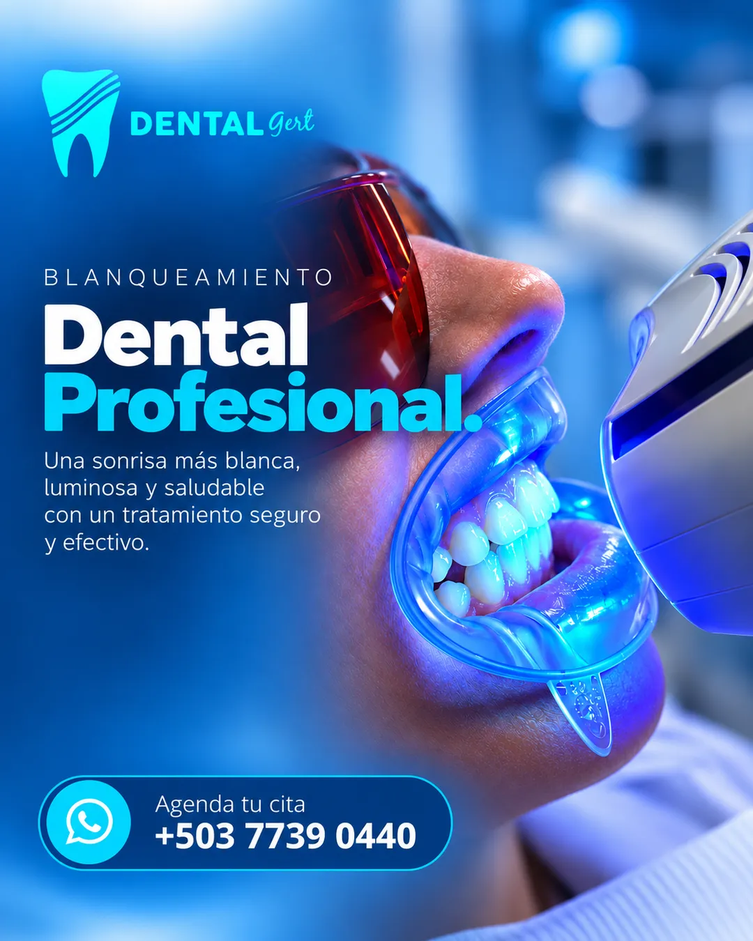 Pieza «Blanqueamiento dental profesional»: una sonrisa más blanca, luminosa y saludable.