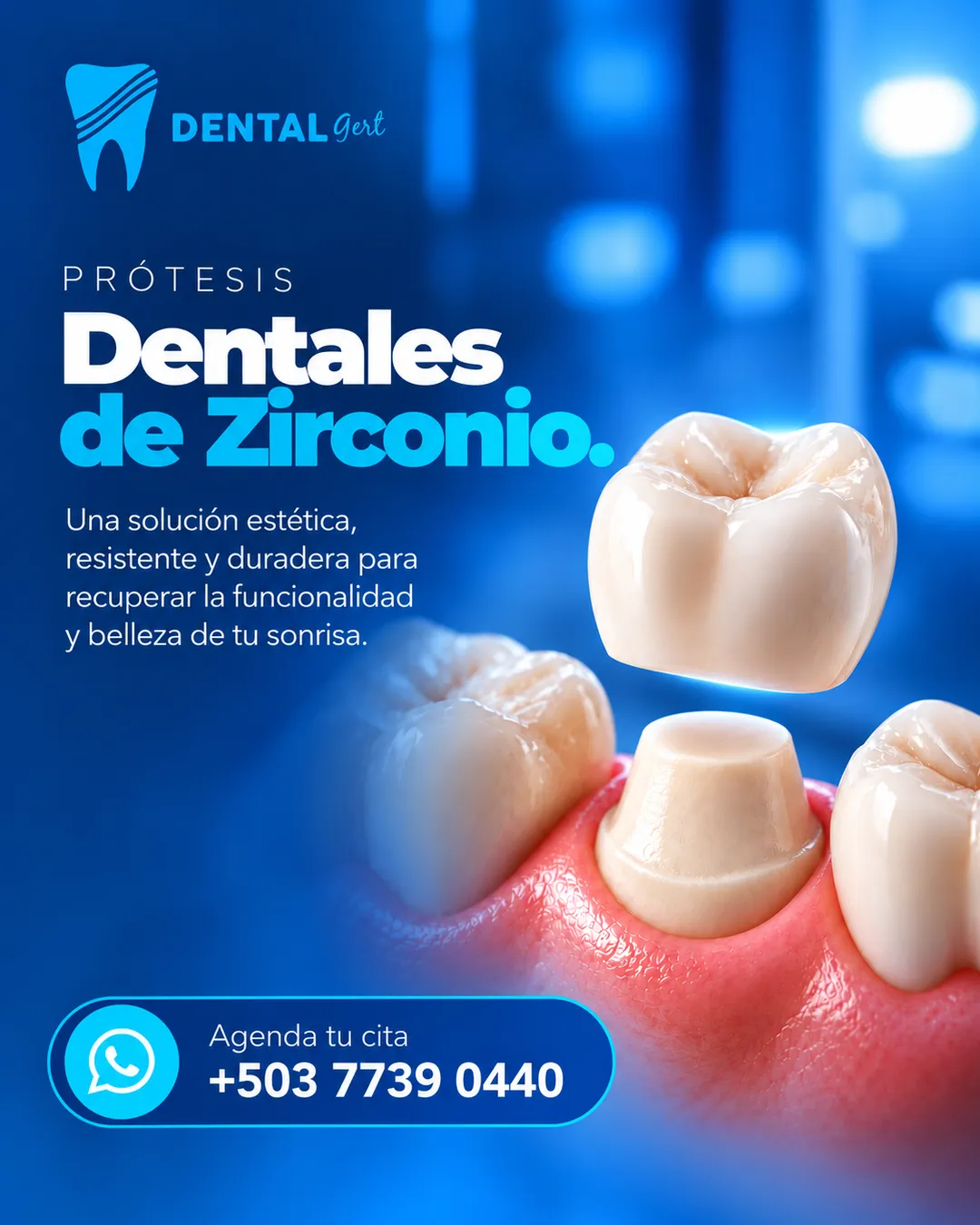 Pieza «Prótesis dentales de zirconio»: una solución estética, resistente y duradera.